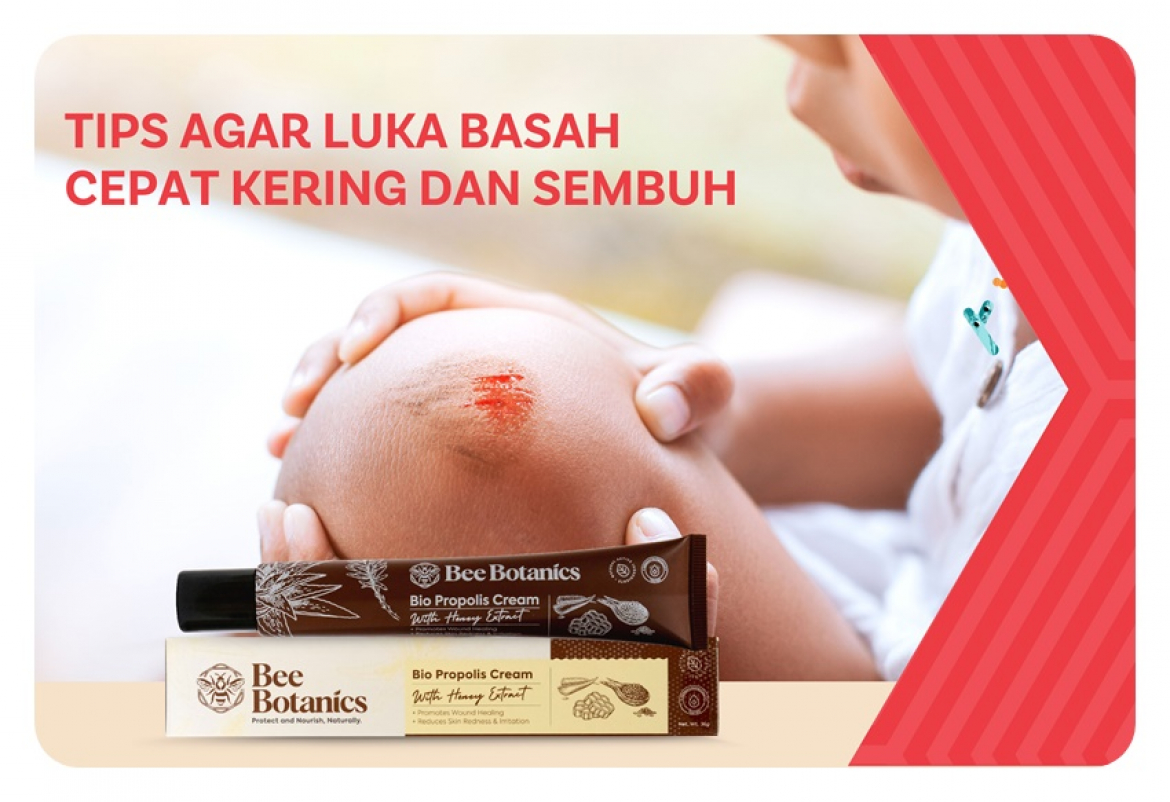 Tips Agar Luka Basah Cepat Kering dan Sembuh